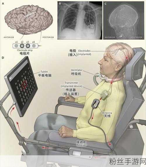 跨界创新，马斯克脑机接口技术或成手游医疗新篇章